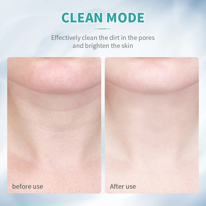 ANLAN Neck & Face Beauty Device – EMS Lifting Tool with LED Light Therapy for Skin Tightening & Anti-Aging