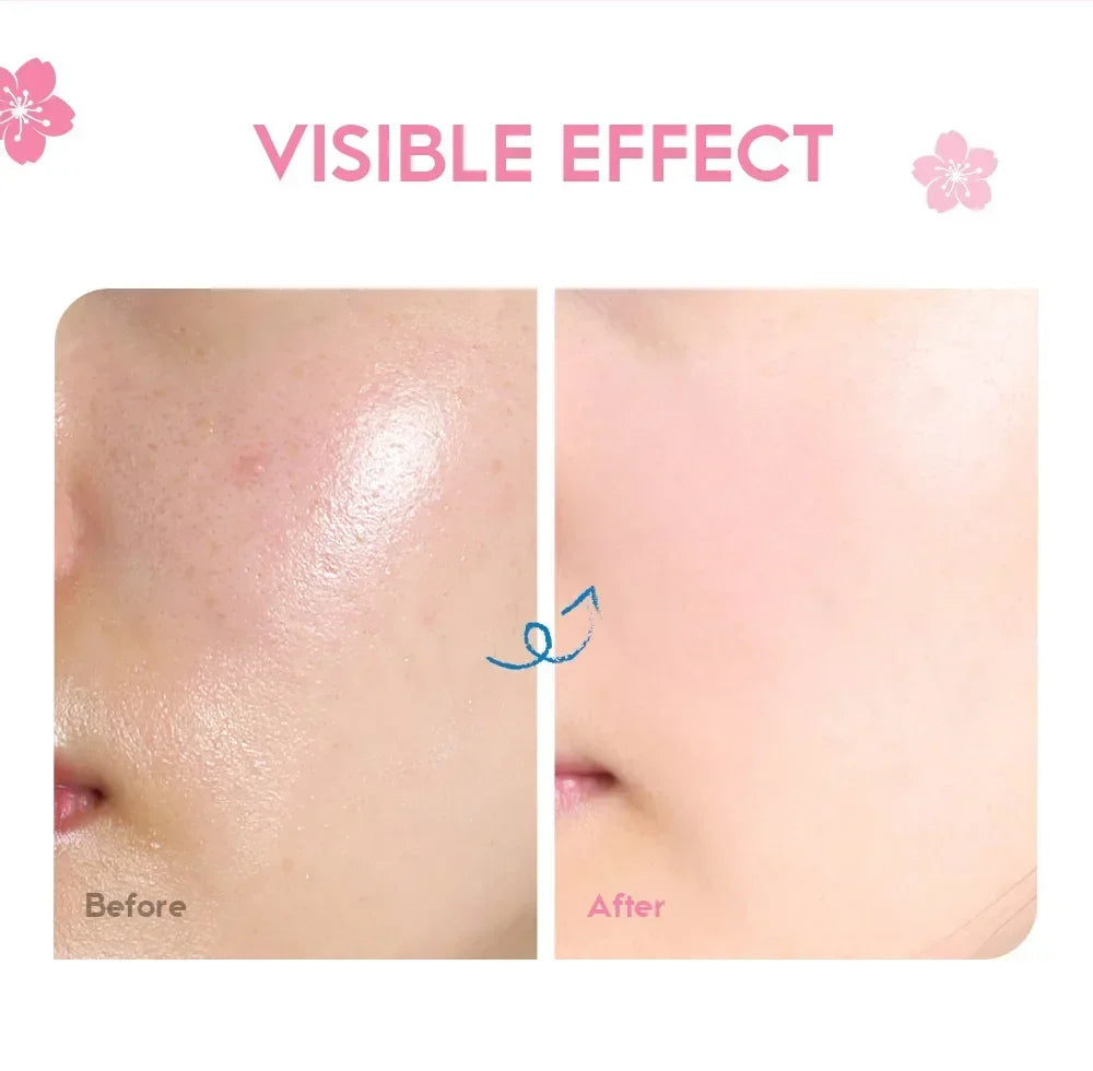LAIKOU Japan Sakura Face Cream – Smoothing Moisturizer, Whitening & Nourishing, Oil Control & Skin Repair, Hydrating Skincare 25g