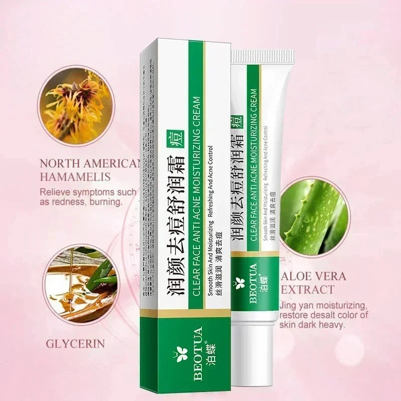 Herbal Acne Treatment Cream – Scar & Blackhead Remover Gel | Oil Control, Pore Minimizing, Whitening & Repair | Korean Skincare