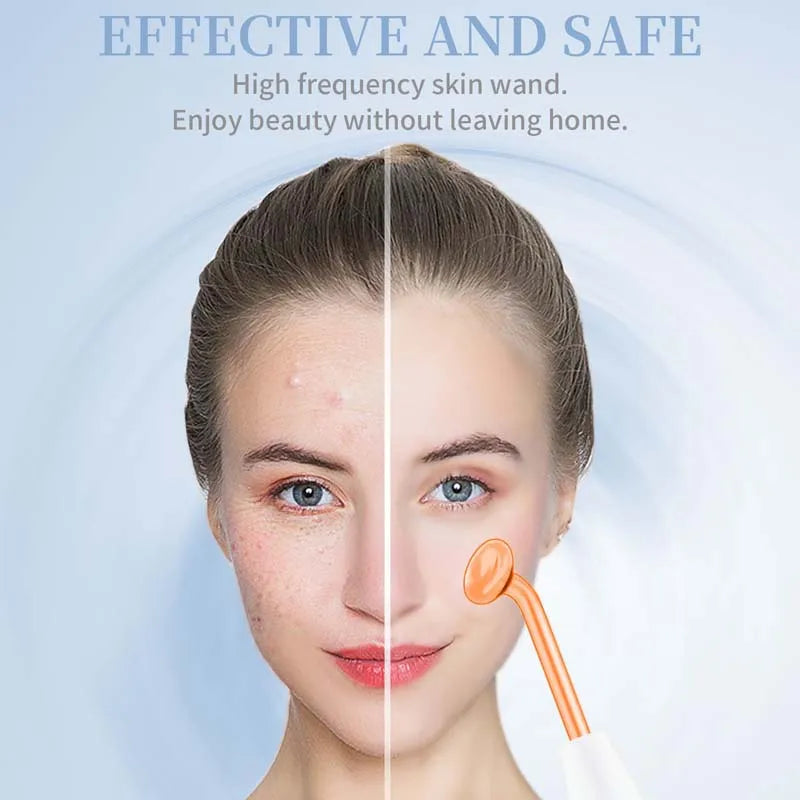 High Frequency Facial Wand – Portable Skin Care Machine with 4 Tube Attachments