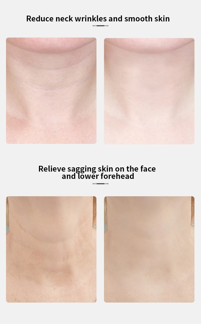 ANLAN Neck & Face Beauty Device – EMS Lifting Tool with LED Light Therapy for Skin Tightening & Anti-Aging