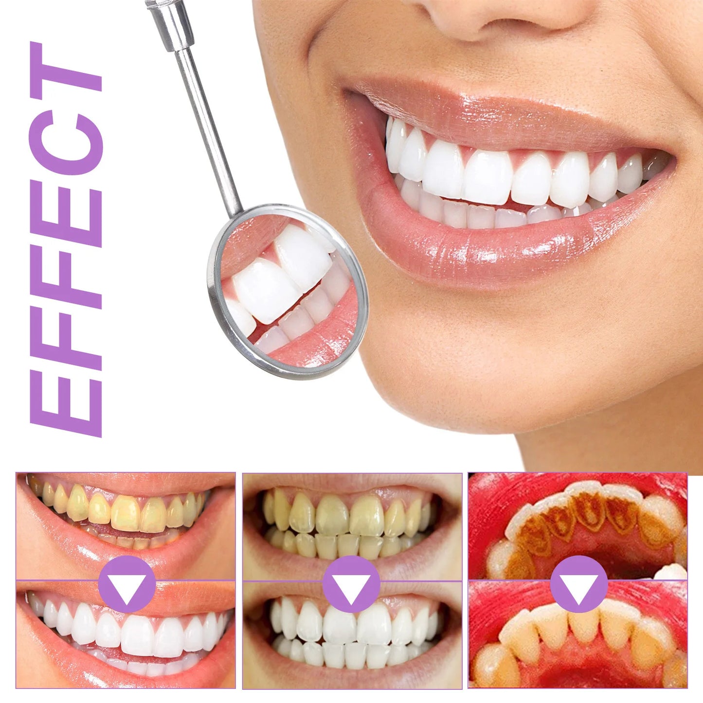 Purple Teeth Whitening Strips – Remove Stains, Fresh Breath & Brighten Smile