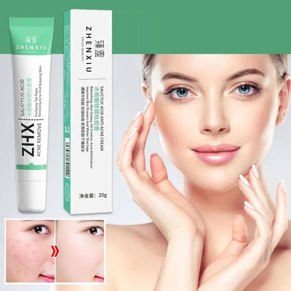 20g Salicylic Acid Pore Minimizing Cream – Blackhead Removal, Large Pore Reduction, Skin Smoothing & Repairing Face Cream | Skincare