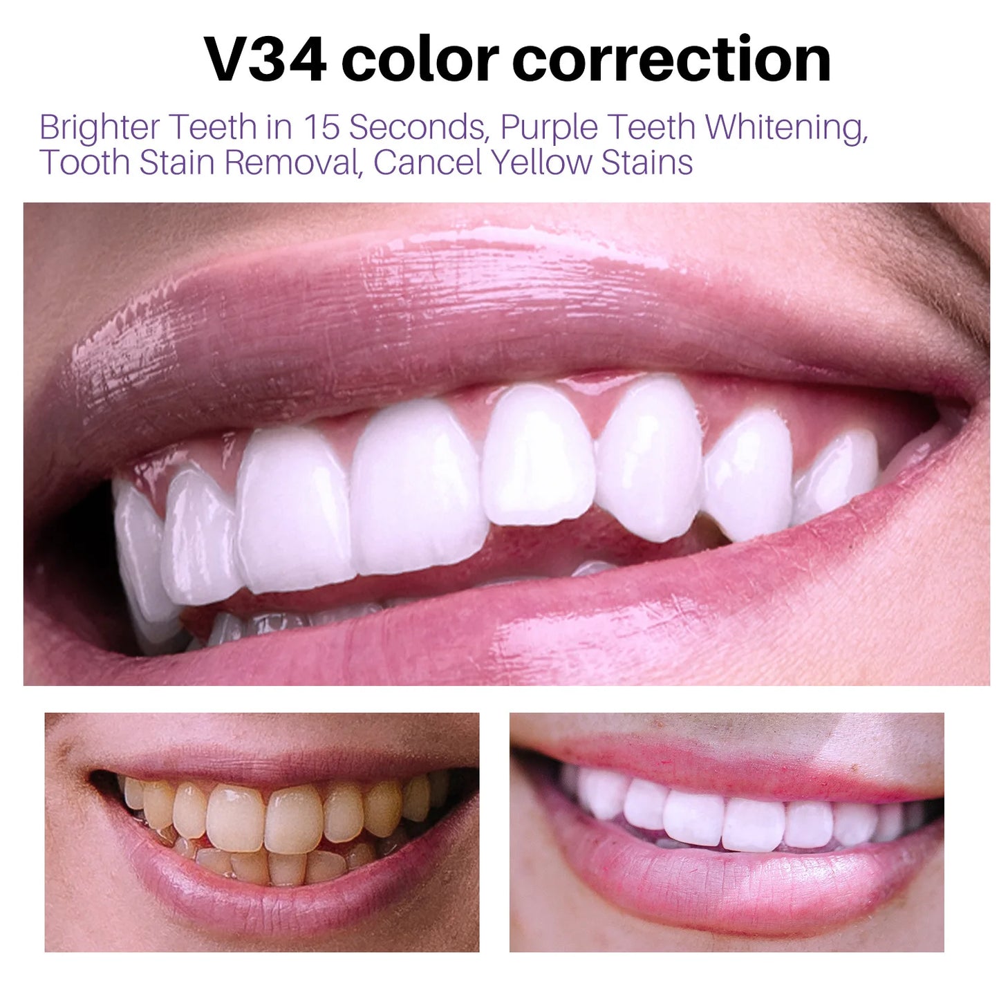 Purple Teeth Whitening Strips – Remove Stains, Fresh Breath & Brighten Smile