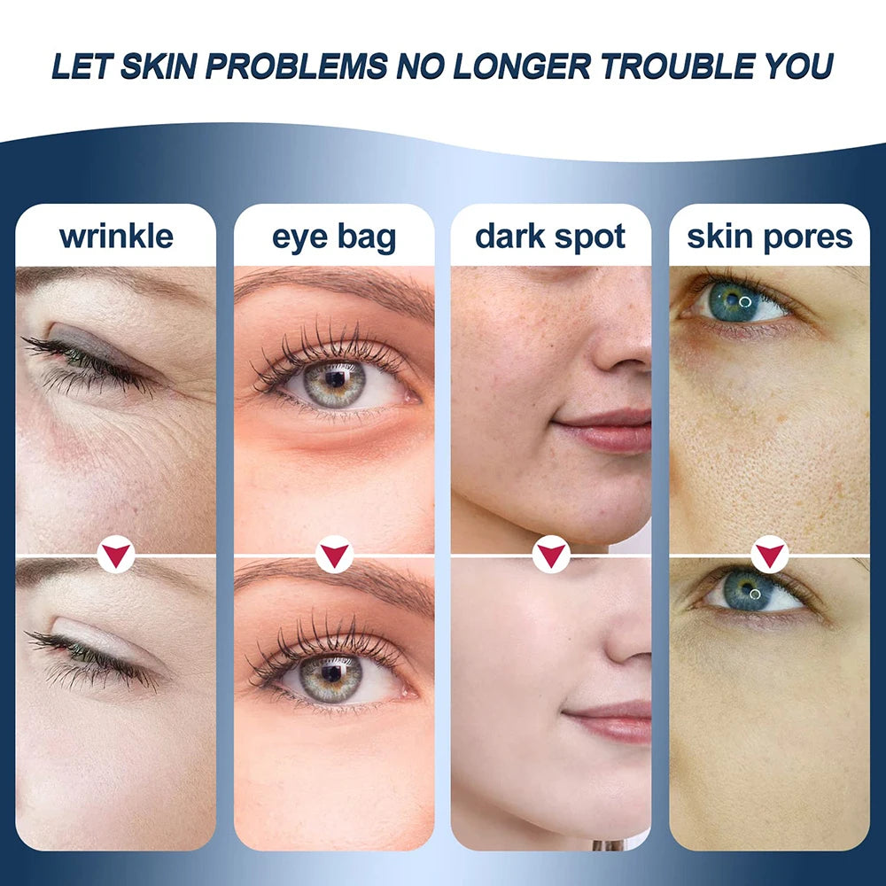 Mini HIFU Eye Lifting Machine – Rechargeable RF & EMS Skin Tightening Device