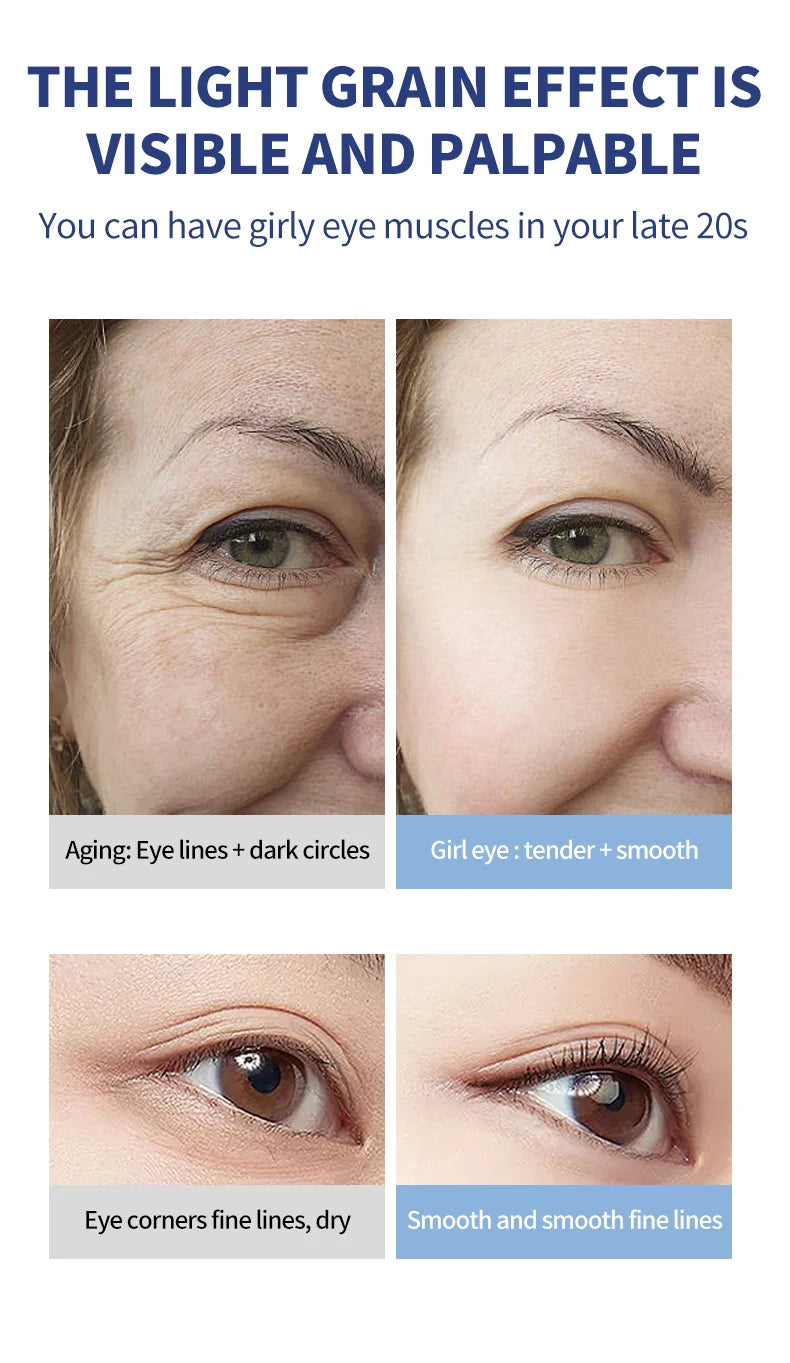 OCHEAL Electric Massage Eye Cream – Hyaluronic Acid Gel for Firming, Fine Line Reduction & Moisturizing Eye Care