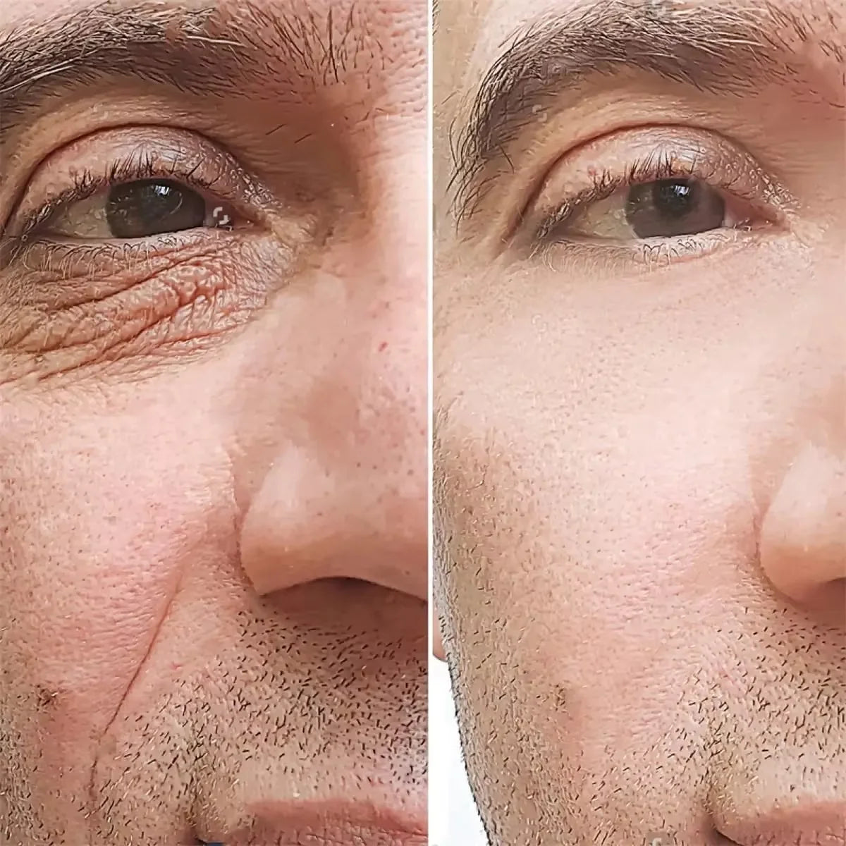 Retinol Anti-Wrinkle Cream for Men – Collagen Boost & Moisturizing Anti-Aging Face Care