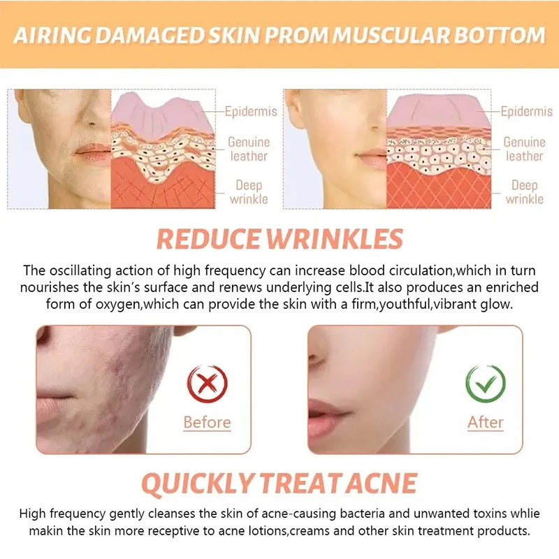 4-in-1 High Frequency Facial Therapy Wand – Galvanic Skin Care & Hair Growth Tool
