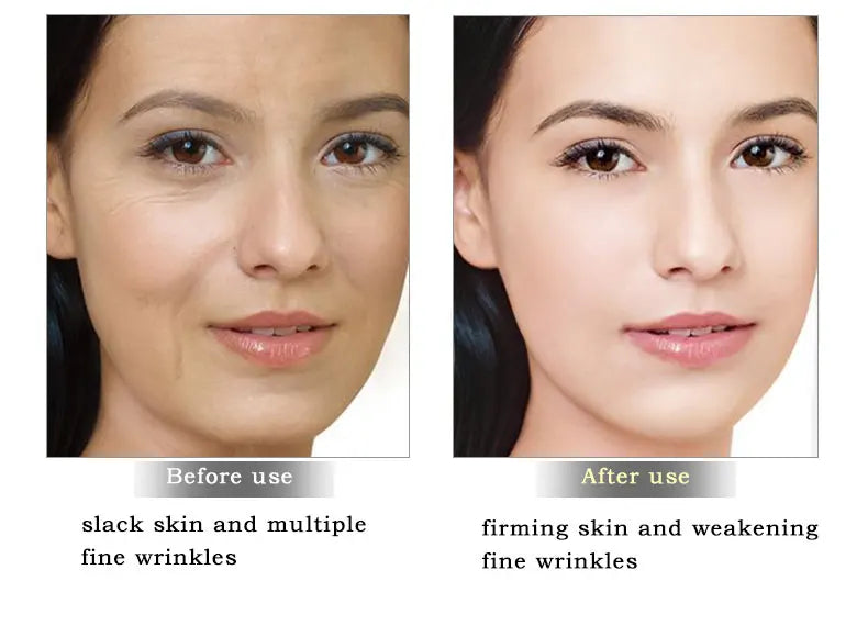 ARTISCARE Snail Repair & Peptide Facial Cream – 2PCS Moisturizing & Nourishing Skin Care Set