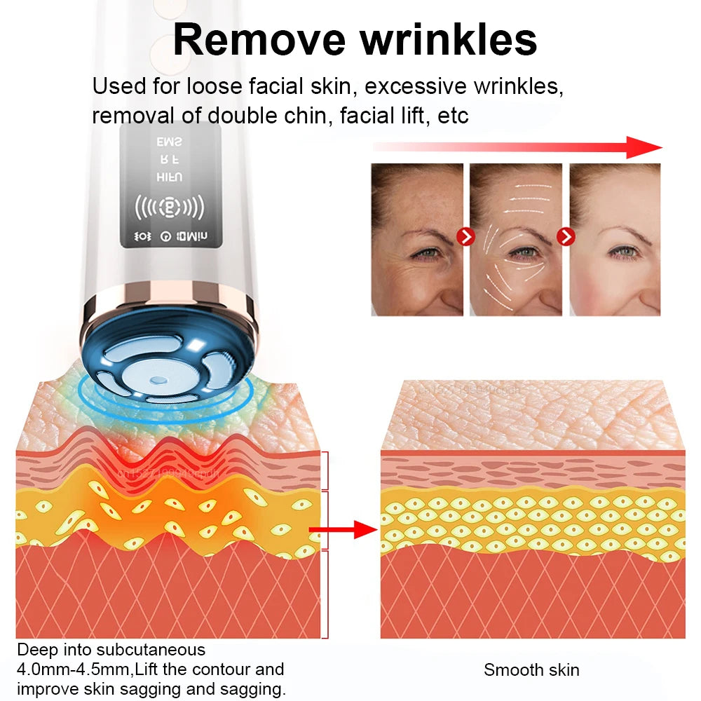 HIFU Face Lifting Machine – RF High Frequency EMS Anti-Aging Facial Massager