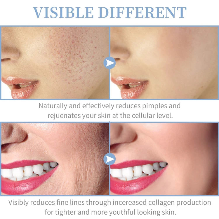 Portable High Frequency Skin Therapy Wand – Acne, Rejuvenation & Wrinkle Reduction Tool