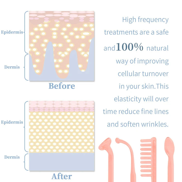 Portable High Frequency Skin Therapy Wand – Acne, Rejuvenation & Wrinkle Reduction Tool