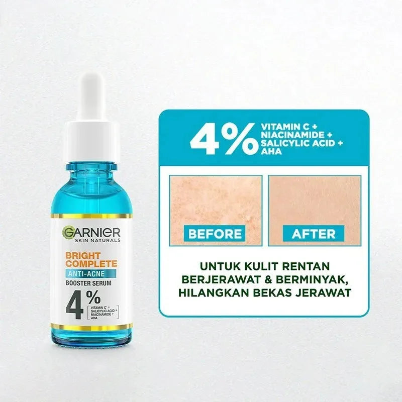 Garnier Whitening Serum – Clears Acne Marks & Tightens Pores
