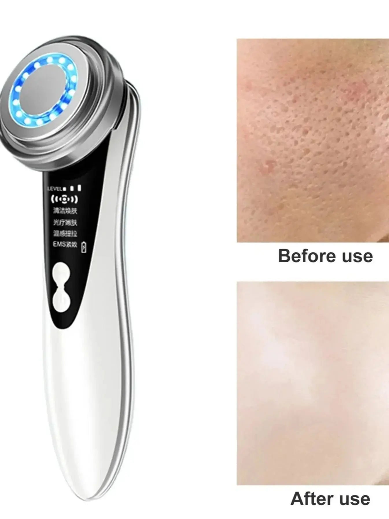 5-in-1 Facial Massager – LED Light Therapy, Eye Care & Skin Smoothing | USB Rechargeable Skincare Device