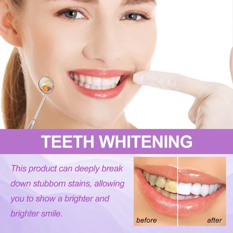 Purple Teeth Whitening Strips – Remove Stains, Fresh Breath & Brighten Smile