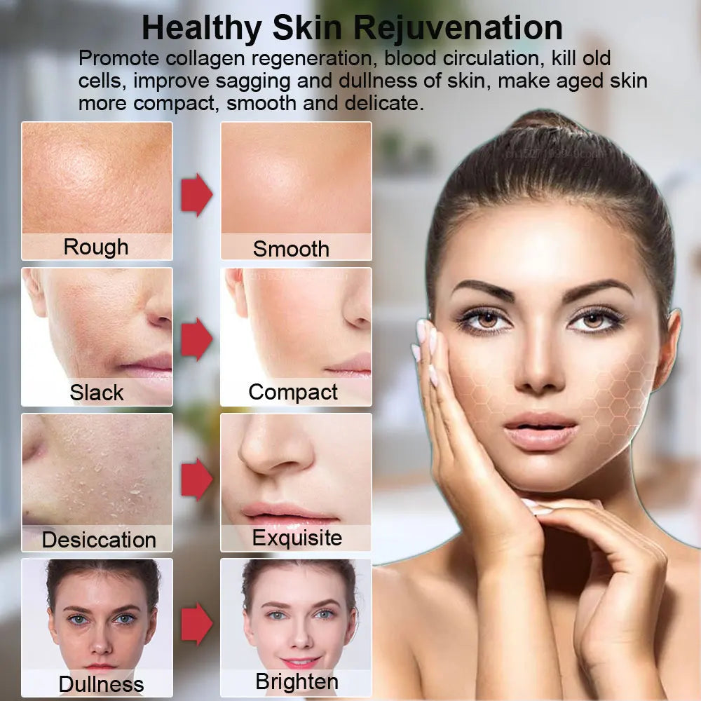 HIFU Face Lifting Machine – RF High Frequency EMS Anti-Aging Facial Massager