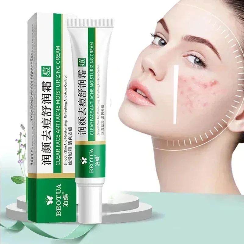 Herbal Acne Treatment Cream – Scar & Blackhead Remover Gel | Oil Control, Pore Minimizing, Whitening & Repair | Korean Skincare