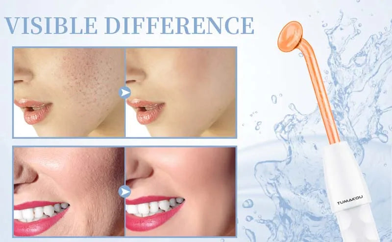 High Frequency Facial Wand – Portable Skin Care Machine with 4 Tube Attachments