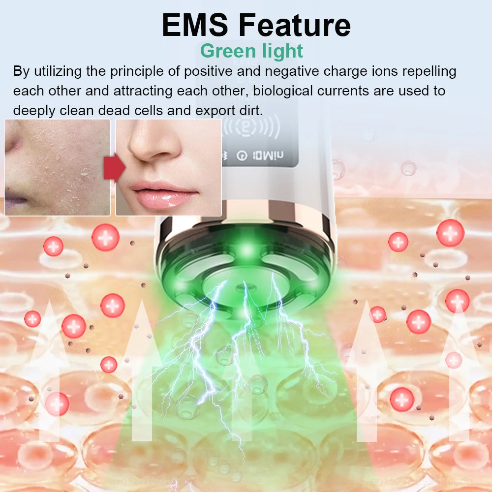 HIFU Face Lifting Machine – RF High Frequency EMS Anti-Aging Facial Massager