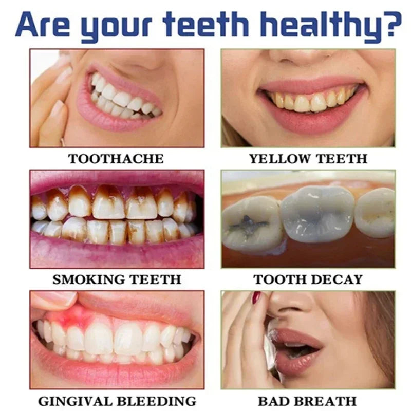 Purple Teeth Whitening Strips – Remove Stains, Fresh Breath & Brighten Smile