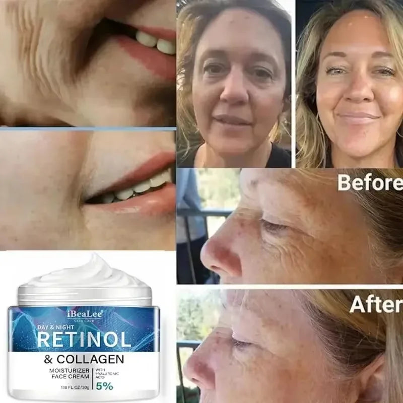Retinol Anti-Wrinkle Cream for Men – Collagen Boost & Moisturizing Anti-Aging Face Care