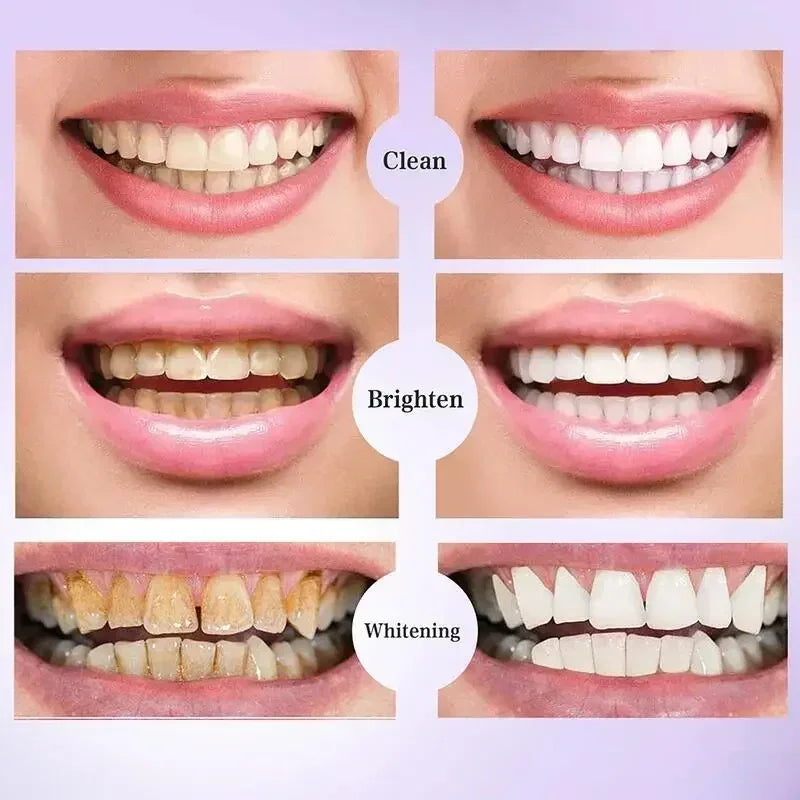 Purple Teeth Whitening Strips – Remove Stains, Fresh Breath & Brighten Smile