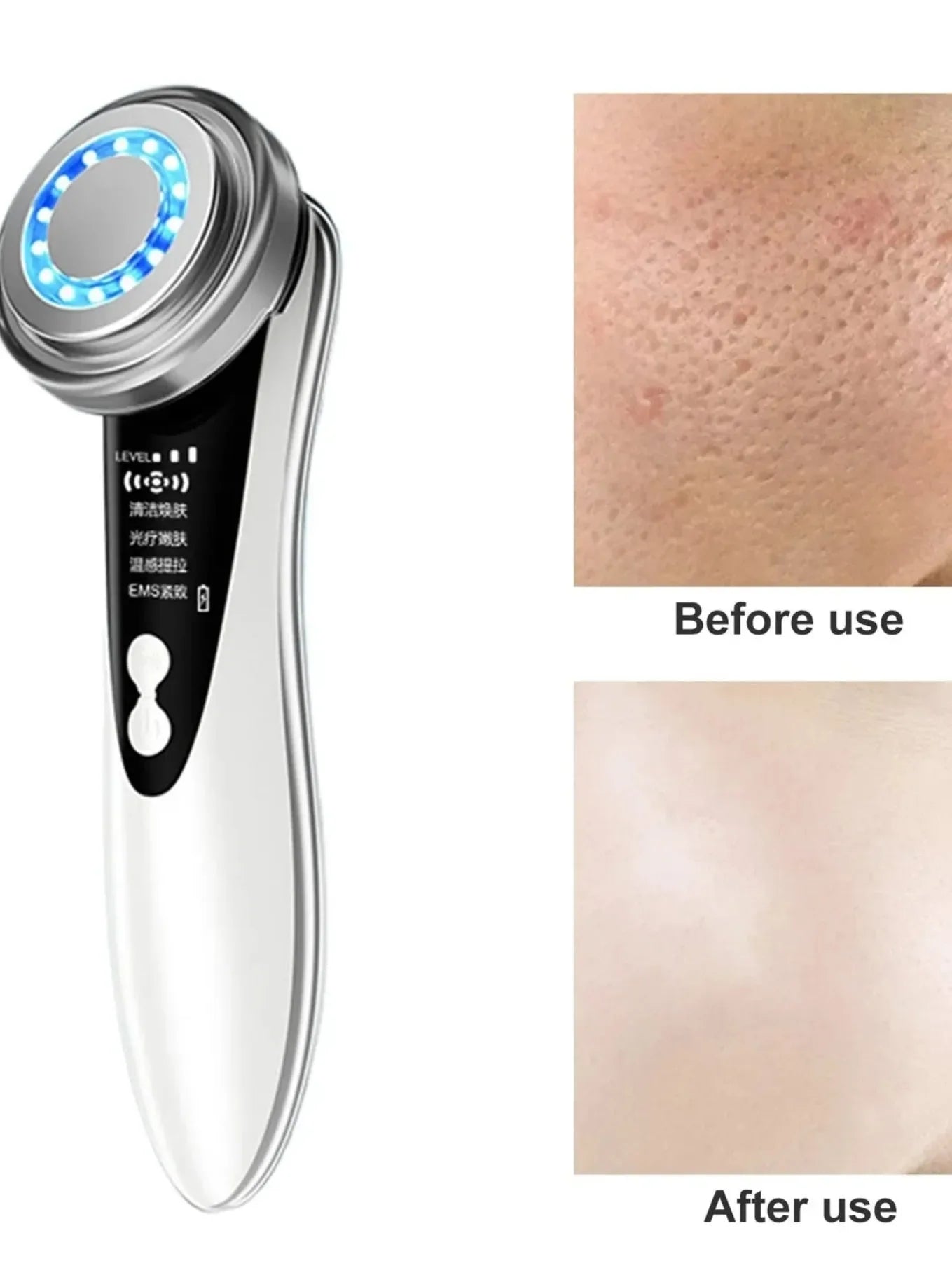 5-in-1 Facial Massager – LED Light Therapy, Eye Care & Skin Smoothing | USB Rechargeable Skincare Device