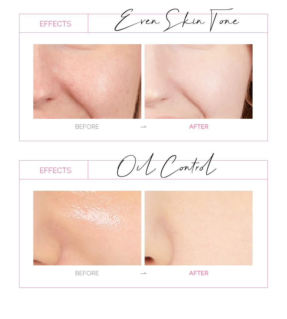 LAIKOU 24K Gold Sakura Peel-Off Mask – Anti-Wrinkle & Blackhead Removal