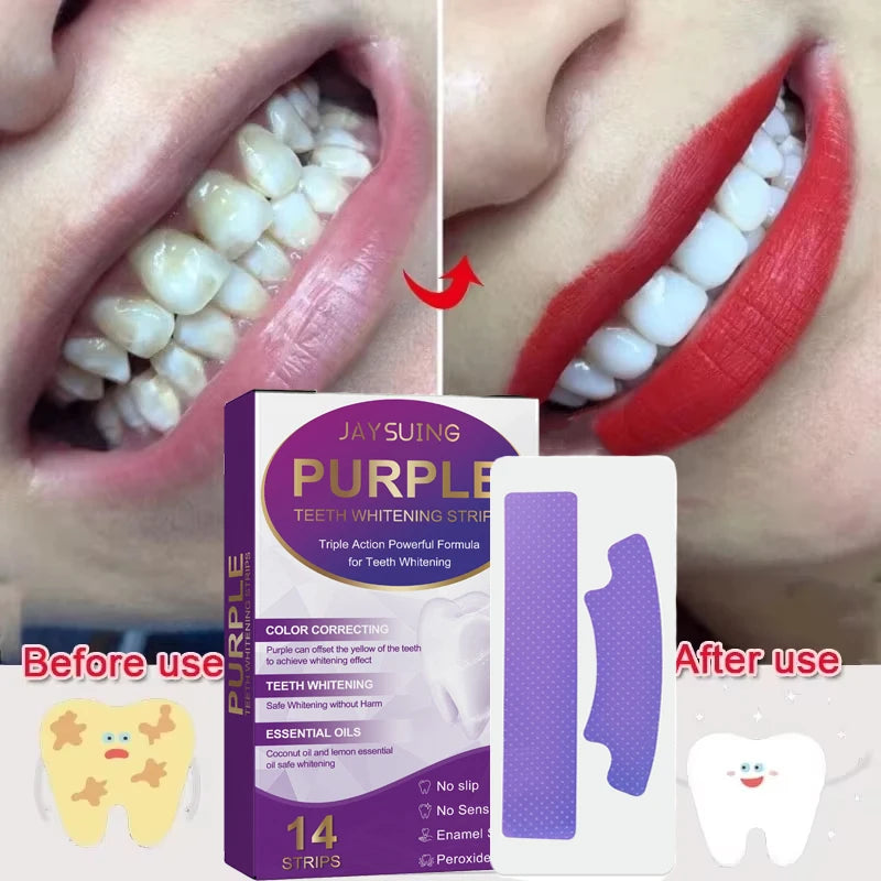 Purple Teeth Whitening Strips – Remove Stains, Fresh Breath & Brighten Smile
